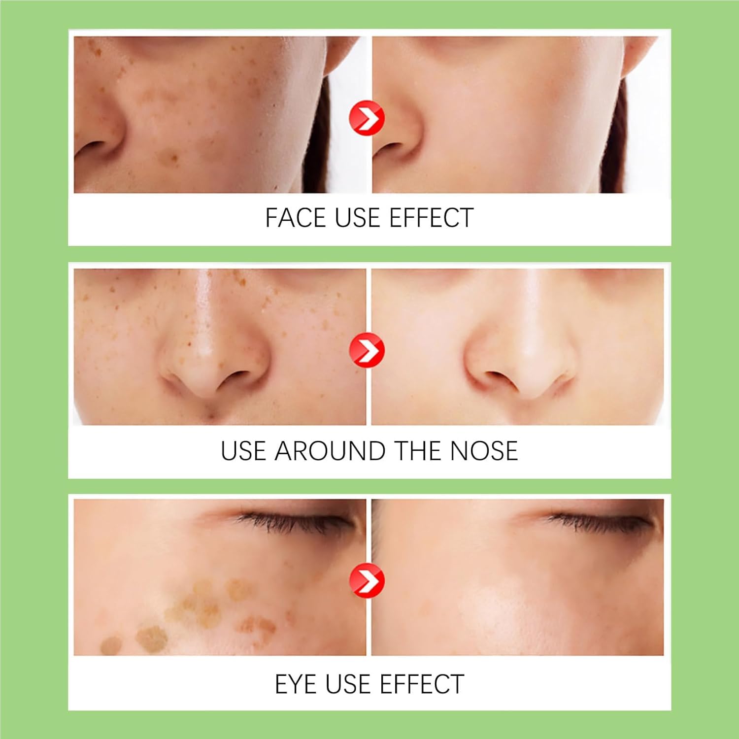 Upgraded Anti-𝐅𝐫𝐞𝐜𝐤𝐥𝐞 Essence Oil, 𝐁𝐫𝐢𝐠𝐡𝐭𝐞𝐧𝐢𝐧𝐠 𝐒𝐩𝐨𝐭 𝐂𝐨𝐫𝐫𝐞𝐜𝐭𝐢𝐧𝐠 Moisturizing Essence Water, Upgraded Body Care Essence Oil, Hydrates Skin Care & Improve Dry Skin Fair
