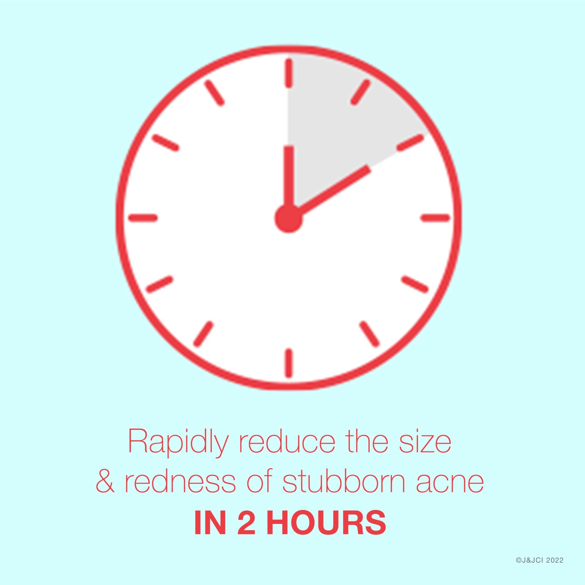 Gel Neutrogena Rapid Clear Stubborn para Manchas de Acné 1 Onza