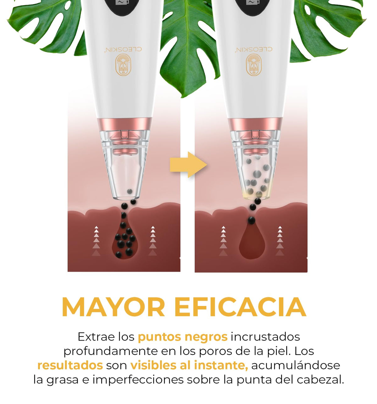 CLEOSKIN Turbo Removedor De Espinillas Limpiador Poros