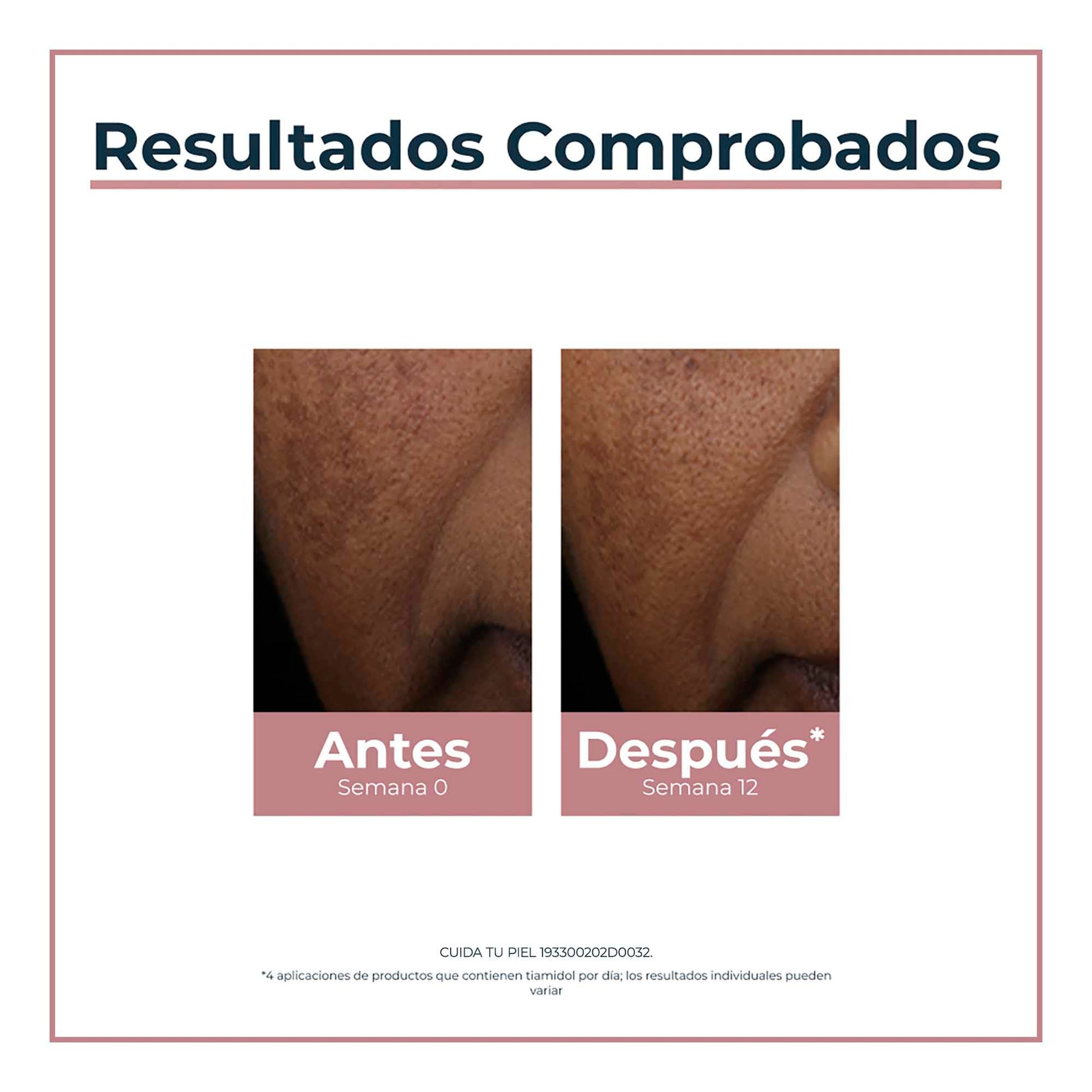 Eucerin Lápiz corrector anti manchas Anti Pigment Spot Corrector, 5ml