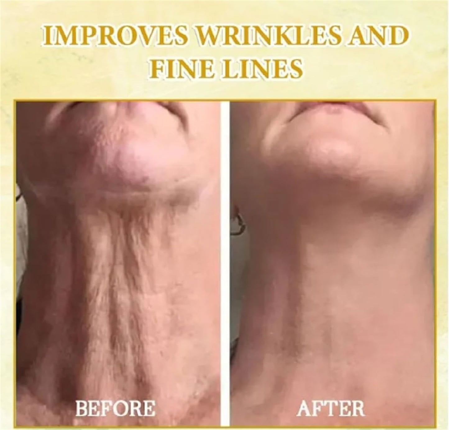 Serum Facial con Ácido Hialurónico y Colágeno para Rejuvenecimiento y Firmeza de la Piel