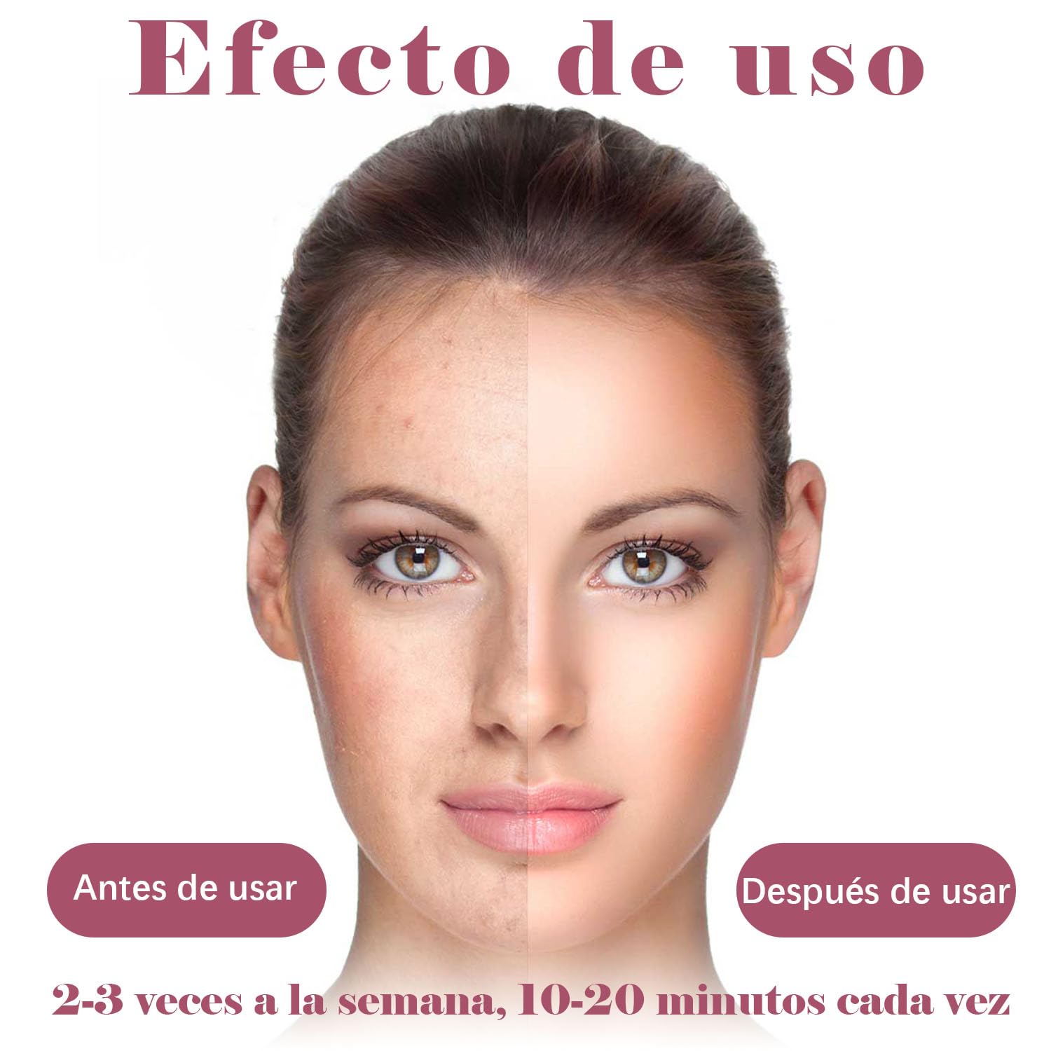Bedpaws Máquina Facial de Alta Frecuencia Portátil de Mano con 4 Tubos Diferentes para Cuidado de la Piel