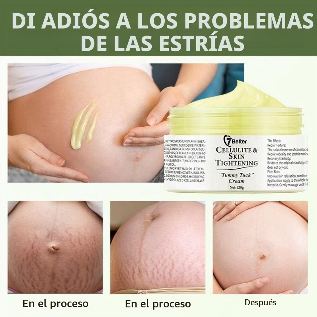 7better LLC Crema Remoción de Estrías y Cicatrices para El Embarazo - Reparación de Cicatrices, Reafirmante Abdominal, y Suave Erradicación de Estrías Cuidado de La Piel Cuerpo