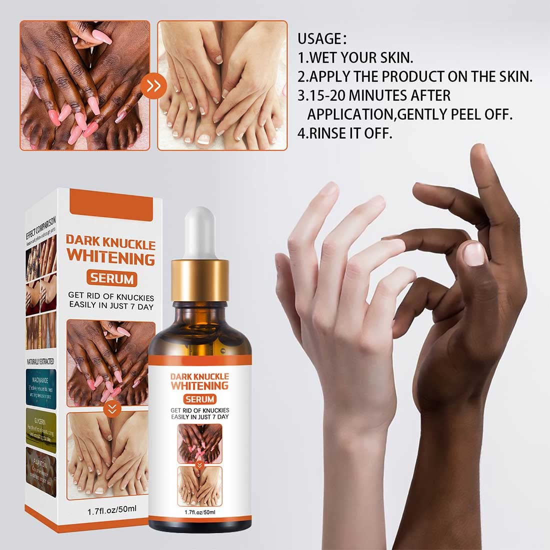 Serum for Dark Spots and Knuckles Whitening, Skin Lightening Oil for Body, Dark Spot Corrector, Whitening Serum to Lighten Skin, Dark Knuckle Remover - Effective Skin Care Solution.