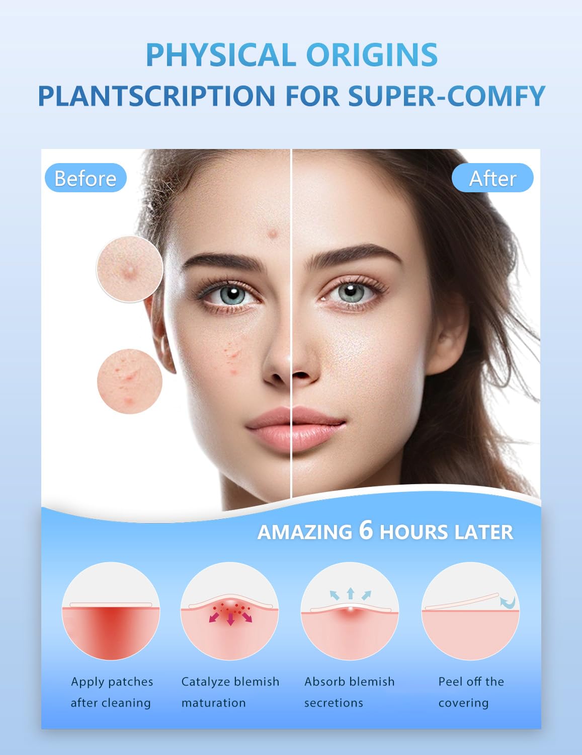 Parches para acne, 255 piezas, 5 colores y 5 tamaños (8, 10, 12, 14, 16 mm), Hidrocoloides pimple patches que se adaptan con precisión a diferentes tamaños de acné, Pegatinas con árbol de té, ácido salicílico y centella