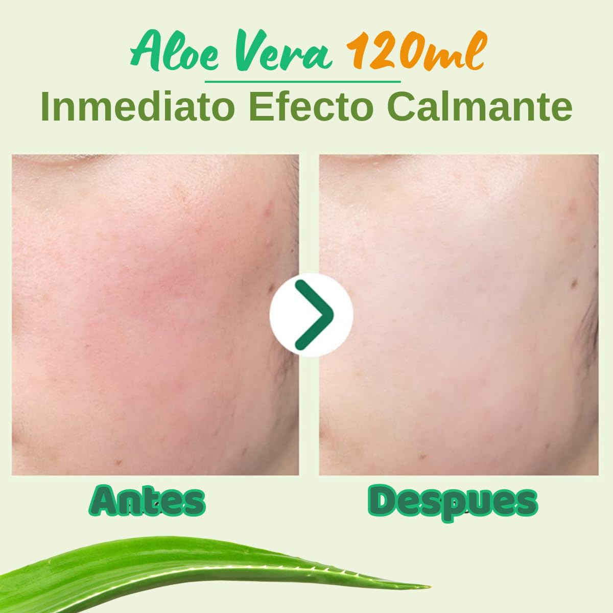 UNIVERSOENLÍNEA.COM Aloe Vera 99% Gel Sábila Hidratacion Facial Piel Blanqueamiento 120ml Elimina Irritación Calmante Natural Efecto Curativo Elimina Acne y Mejora Apariencia Textura Ligera