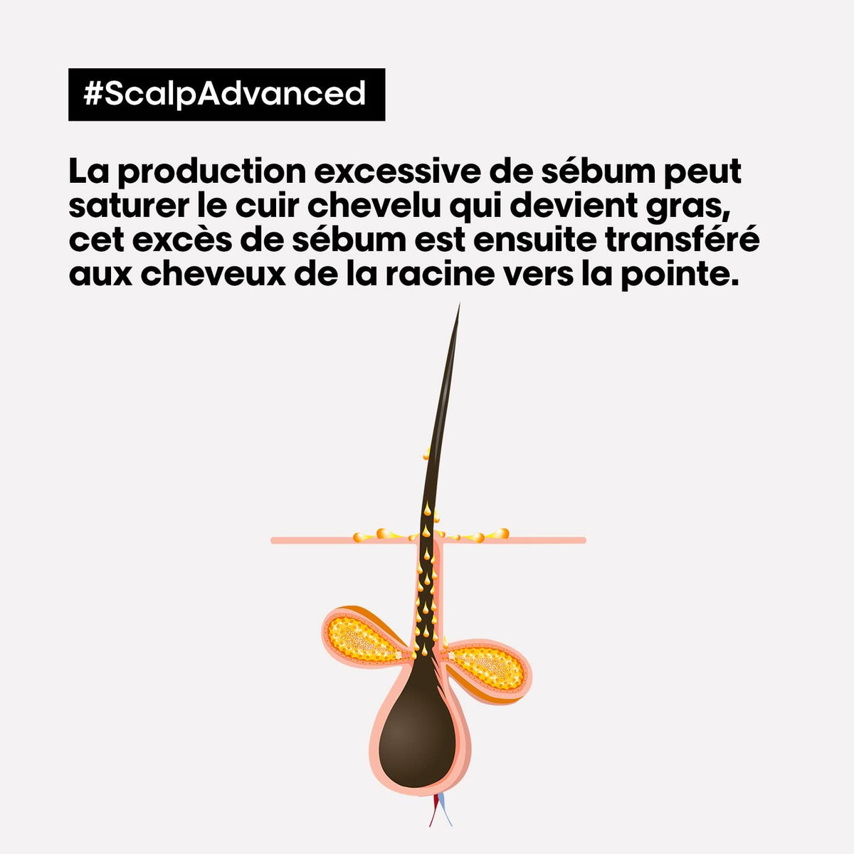 L'Oréal Professionnel Scalp Advanced Shampoo Oleosidad 500ml