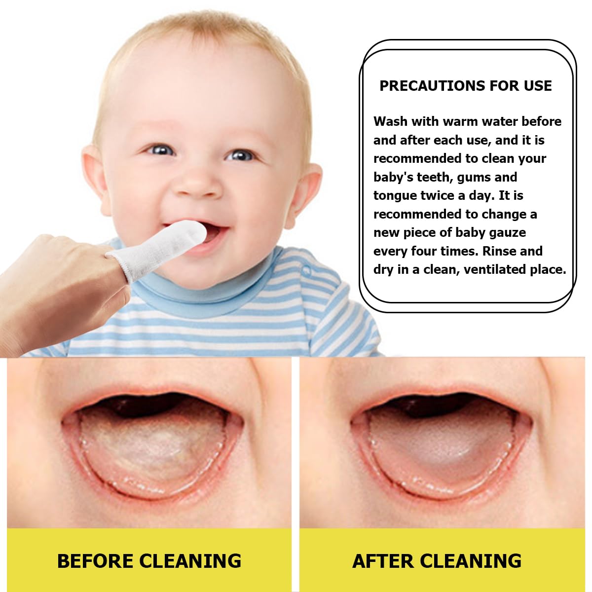 Cepillo de Dientes UPIQNG Beige para Bebé con Gasa y Raspador de Lengua