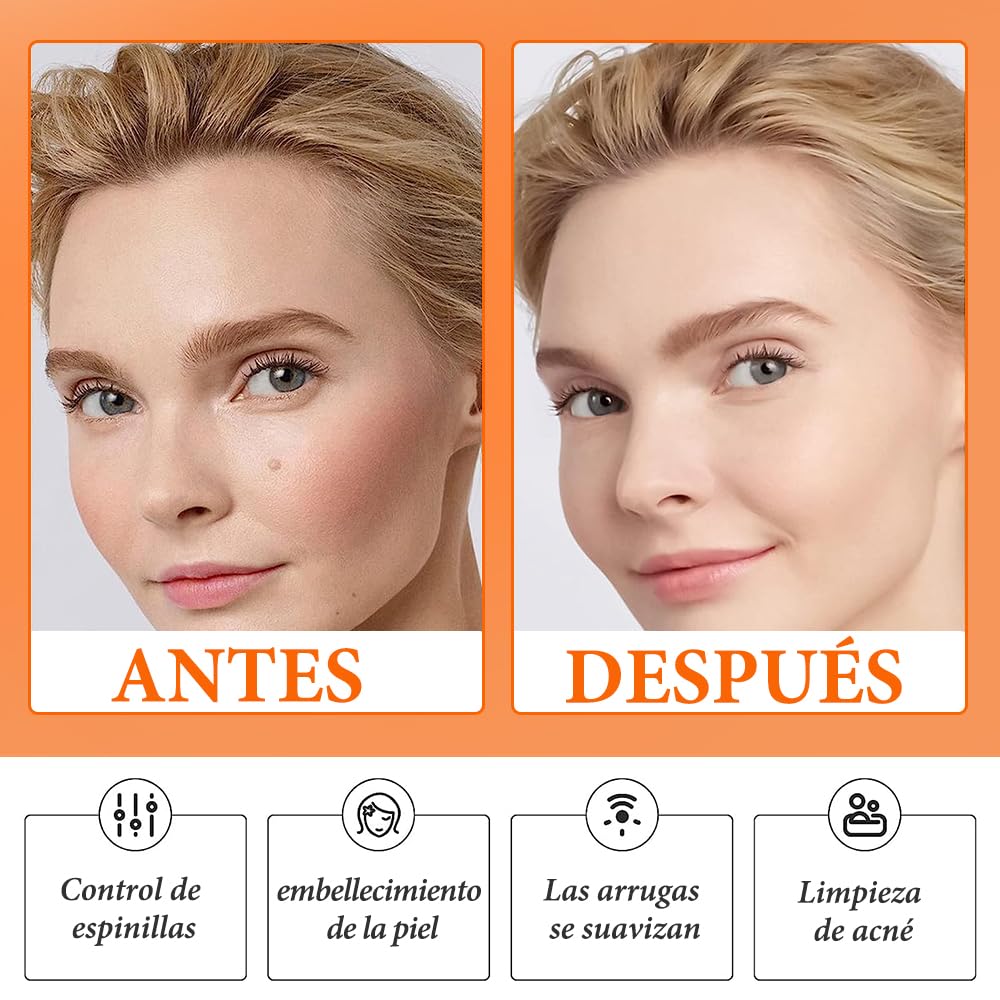 Máquinas Faciales de Alta Frecuencia, Alta Frecuencia Facial, Máquinas Faciales, Equipo De Alta Frecuencia Para La Piel, Viene con 4 Tubos Diferentes, Aguja para El Acné, Espejo e Hisopo con Alcohol
