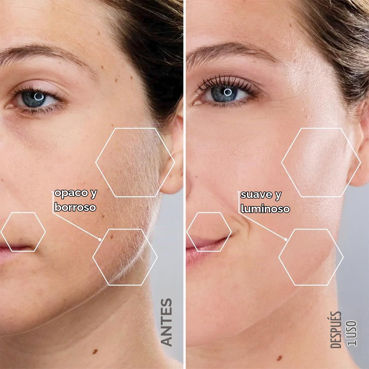 Michael Todd Beauty - Sonicsmooth Dermaplaning Tool - 2 en 1 Peach Fuzz Depilación Facial para Mujeres - Dermaplane - Recargable con suministro de 8 semanas