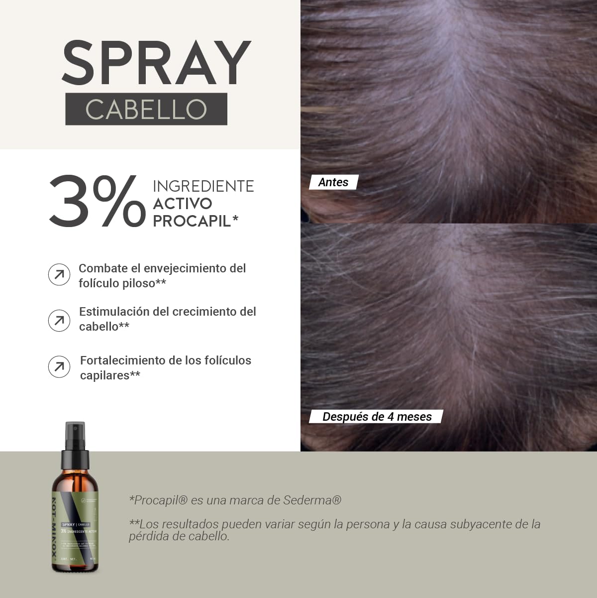 Spray para Crecimiento de Cabello NOT-MINOX 3% Ingrediente Activo con Biotina y Vitamina E