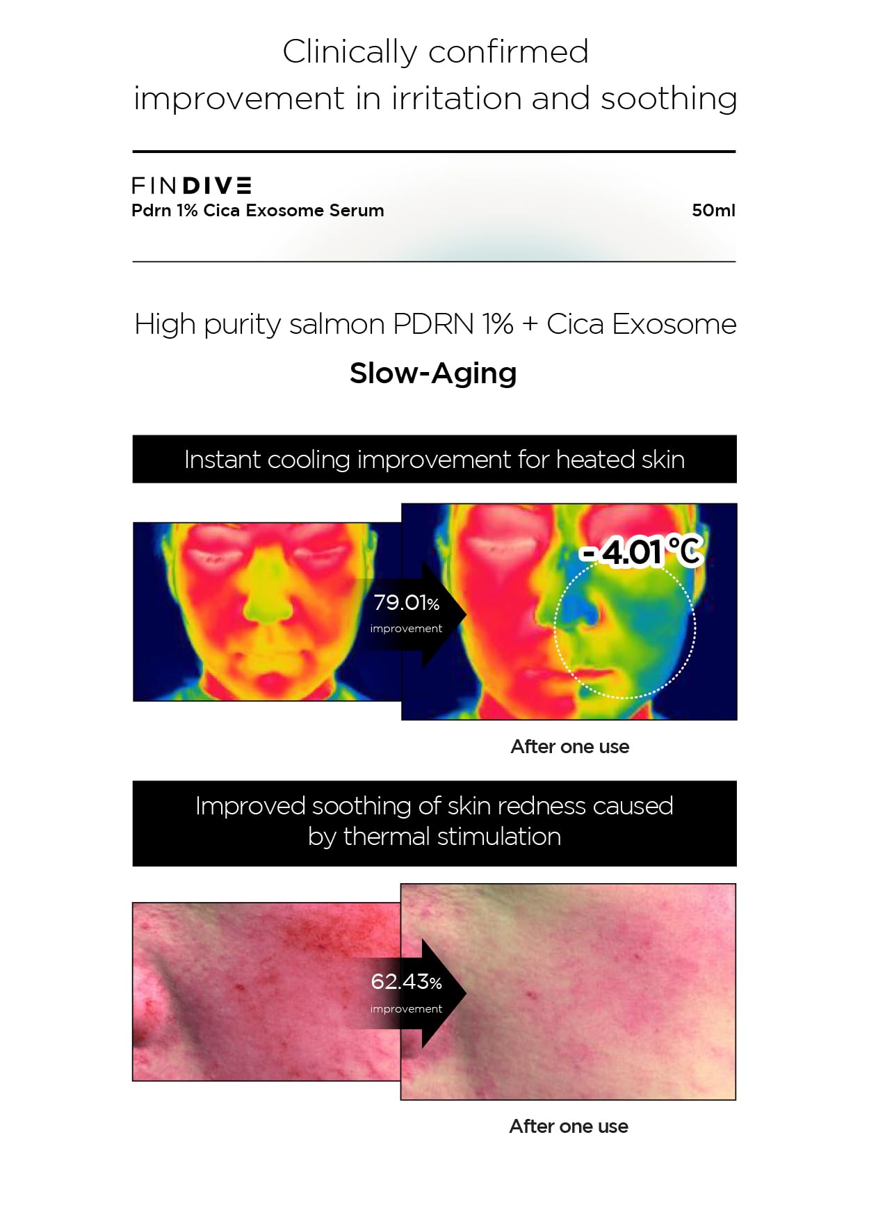 [ OFICIAL ] Suero de exosomas CICA de PDRN, PDRN (ADN sódico) al 1%, exosoma CICA 1000 ppm, colágeno marino, suaviza y regenera la piel, 1,69 fl.oz.