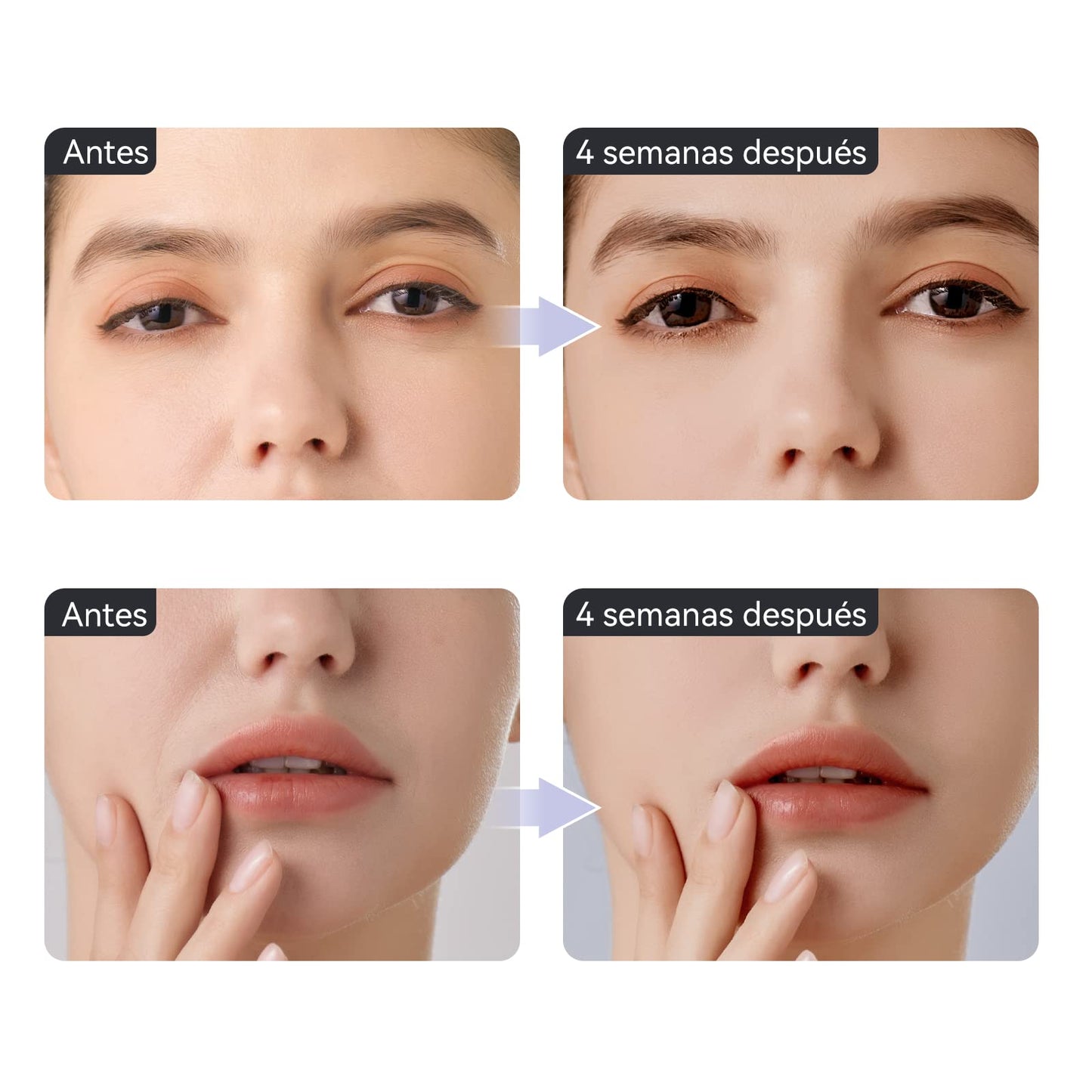 ANLAN Masajeador de Ojos, EMS Dispositivo de Ojos Antiarrugas y Antiedad, Luz Roja& Azu de LED Terapia, 40 ℃ Compresa Caliente,Mejora Ojeras, Bolsas, Hinchazón, Arrugas, Contorno de Ojos