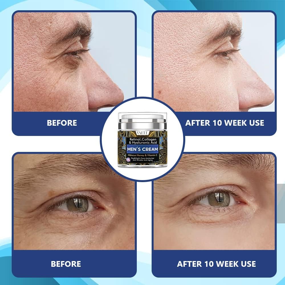 VAITE Crema facial para hombres con colágeno, retinol, antienvejecimiento, antiarrugas debajo de los ojos Crema para el cuidado de la cara para hombres con hibisco y miel, ácido hialurónico, vitamina C Fabricado en EE. UU.