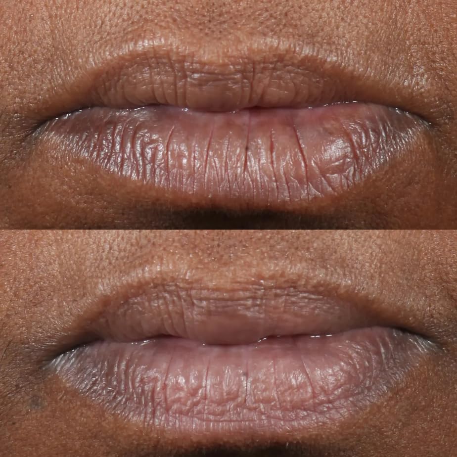 Terapia para Labios Perricone MD Cold Plasma Plus 0.15 oz