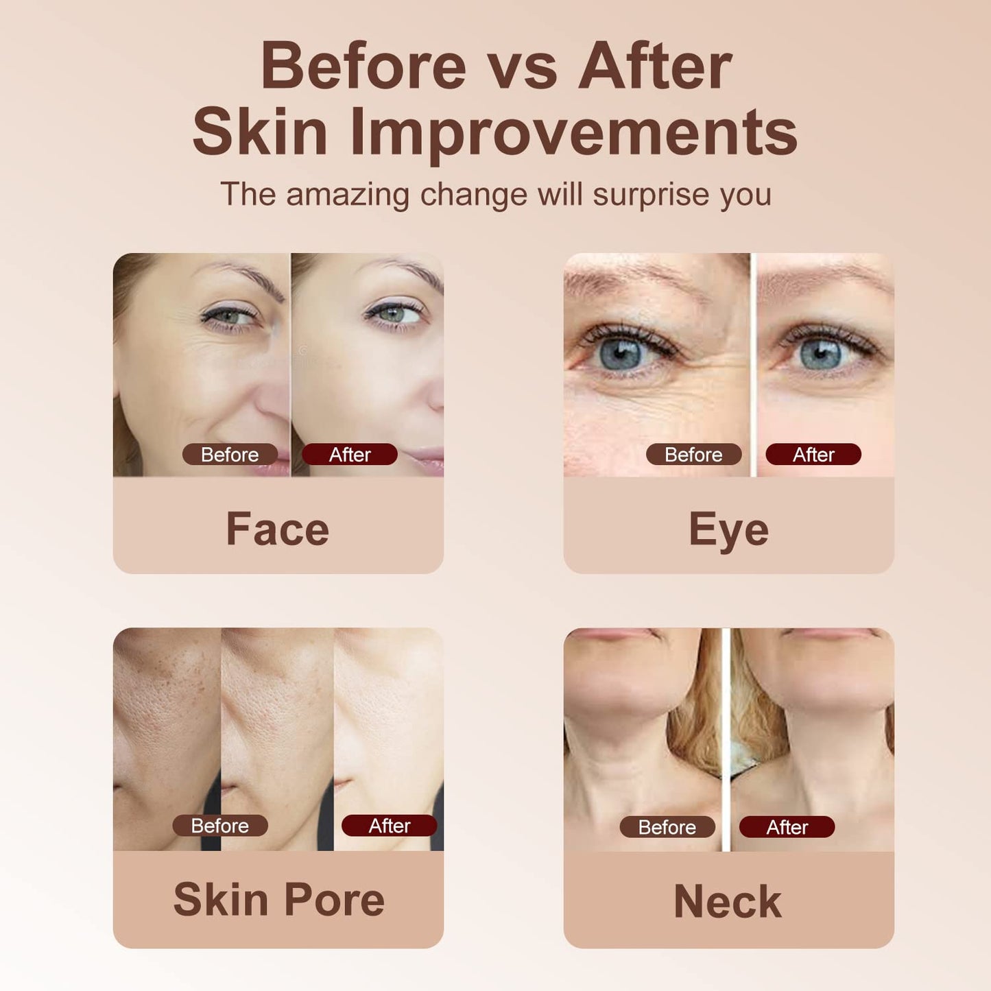 Máquina facial de alta frecuencia, 5 en 1 masajeador facial multifuncional de ajuste de la piel, máquina de terapia de luz para la cara