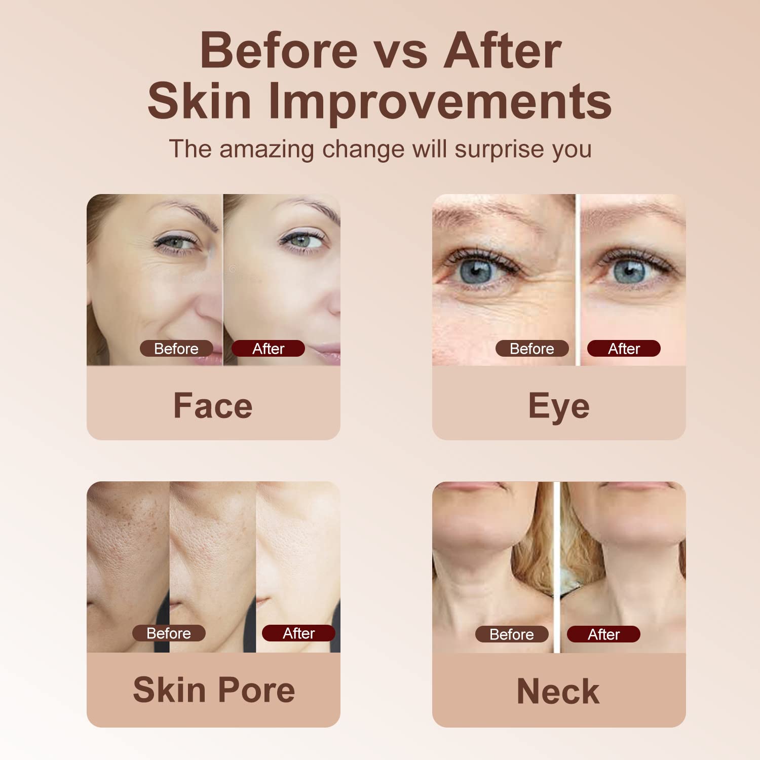 Máquina facial de alta frecuencia, 5 en 1 masajeador facial multifuncional de ajuste de la piel, máquina de terapia de luz para la cara
