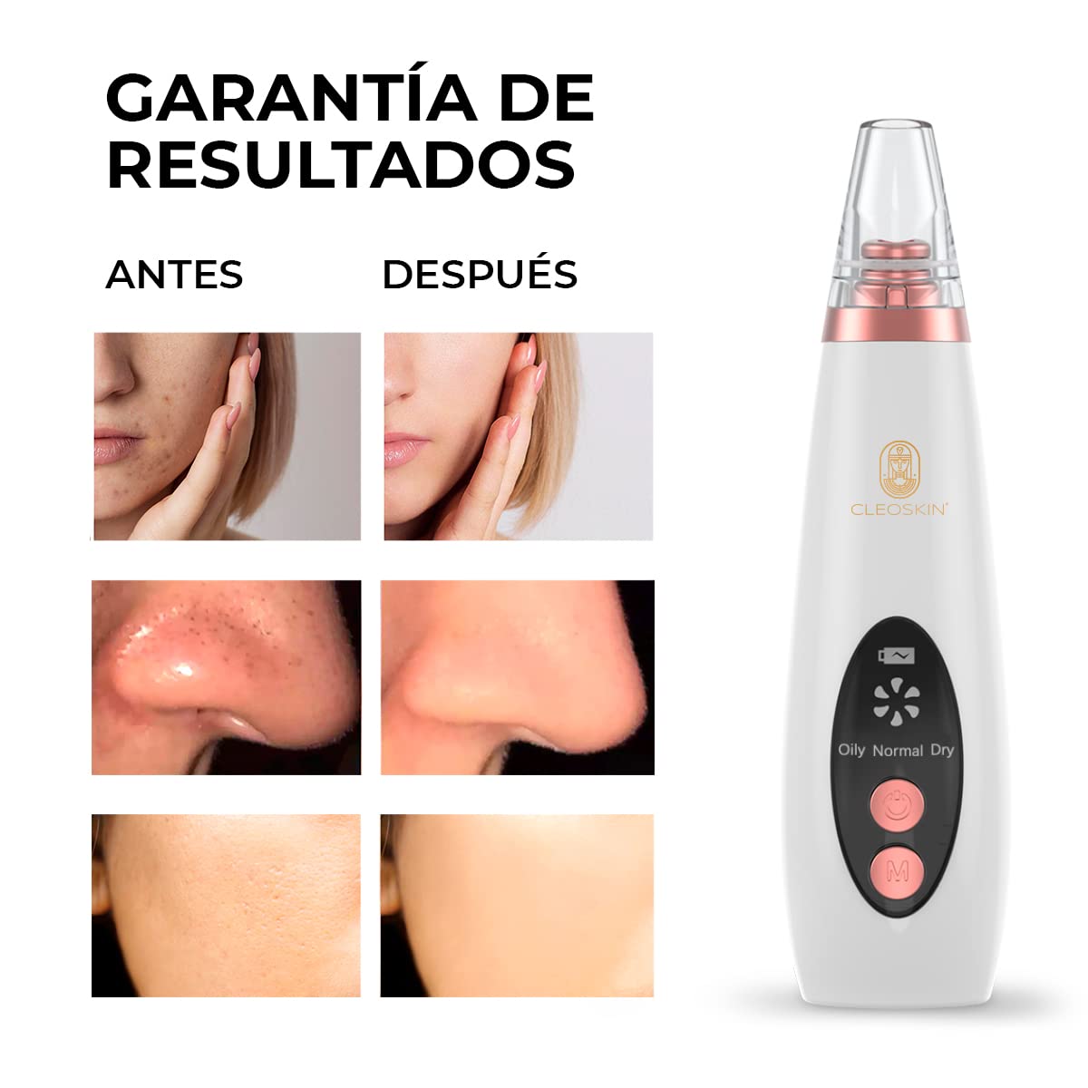 CLEOSKIN Turbo Removedor De Espinillas Limpiador Poros