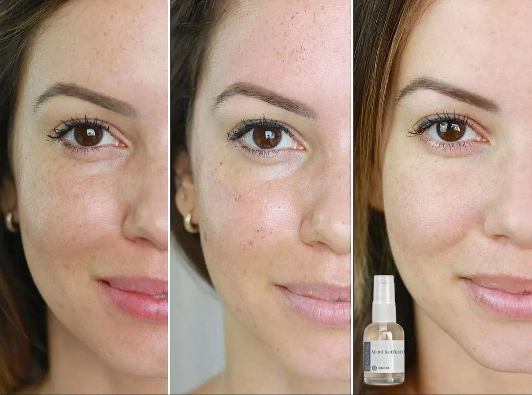 Suero Facial Ácido Glicólico Routine