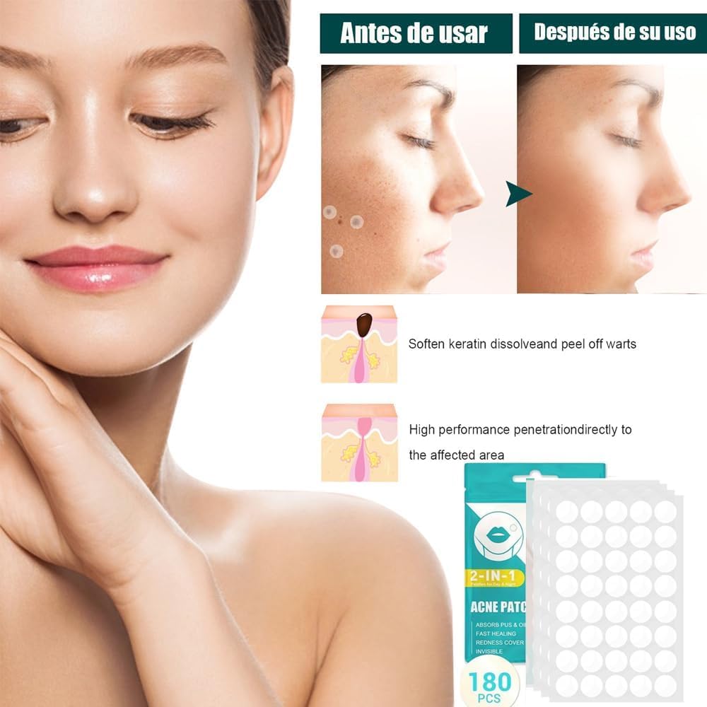 Parches de Piel Hidrocoloides para Acné - Tratamiento Absorbente para Espinillas en la Cara - Pack de 180 Calcomanías Ultra Finas - Cuidado Profesional para la Piel - Absorben Secreciones para una Piel Más Sana y Limpia