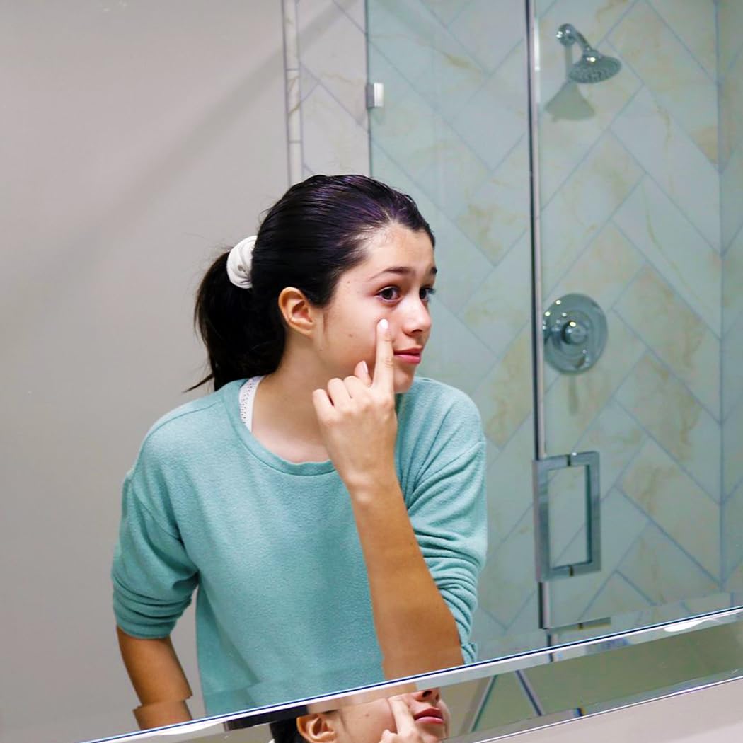 Kidskin - Z-Blast Acne Serum, Preteens, and Teens - Acne Serum - Pimple and Breakout Prevention - 2% Salicylic Acid
