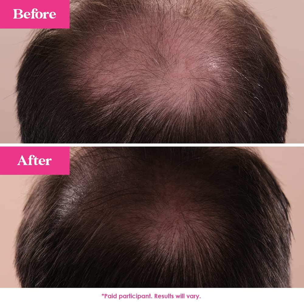 Grande Cosmetics GrandeHAIR - Sérum