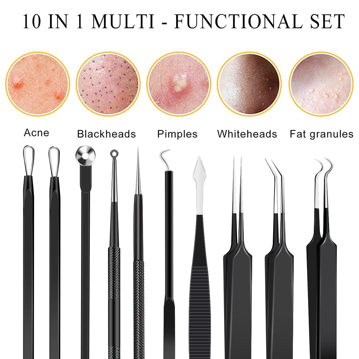 Kit de herramientas de extracción de espinillas, de acero inoxidable, extractor de comedones, para frente, nariz, ligera, con funda de metal para viajes, uso doméstico