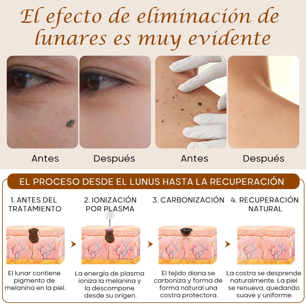 Plasma Pen, 15 Niveles de Ajuste, Con luz LED