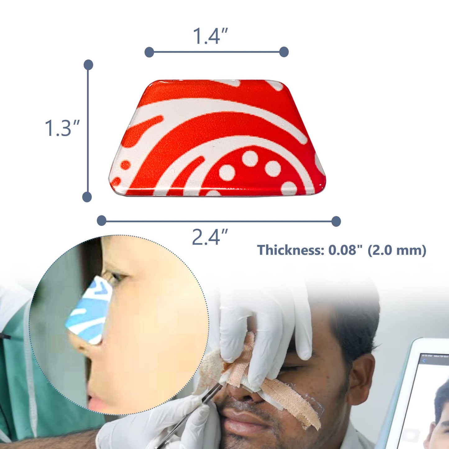 MENURSY - Férulas nasales de aluminio - Rinoplastia Septoplastia Sur-Gery - Protector externo de soporte para la nariz fractura, inmovilización ortopédica, patrón aleatorio