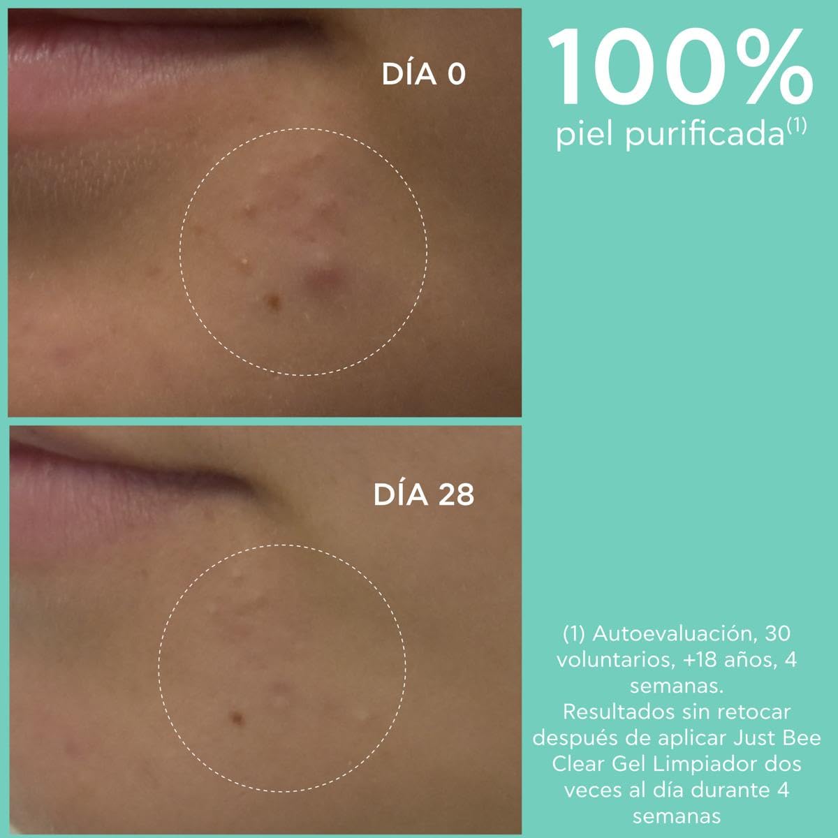 Apivita Just Bee Clear gel limpiador purificante Just Bee Clear 200 ml – con propóleo AmC patentado y ácido salicílico vegetal – limpia en profundidad, purifica y reduce el exceso de sebo