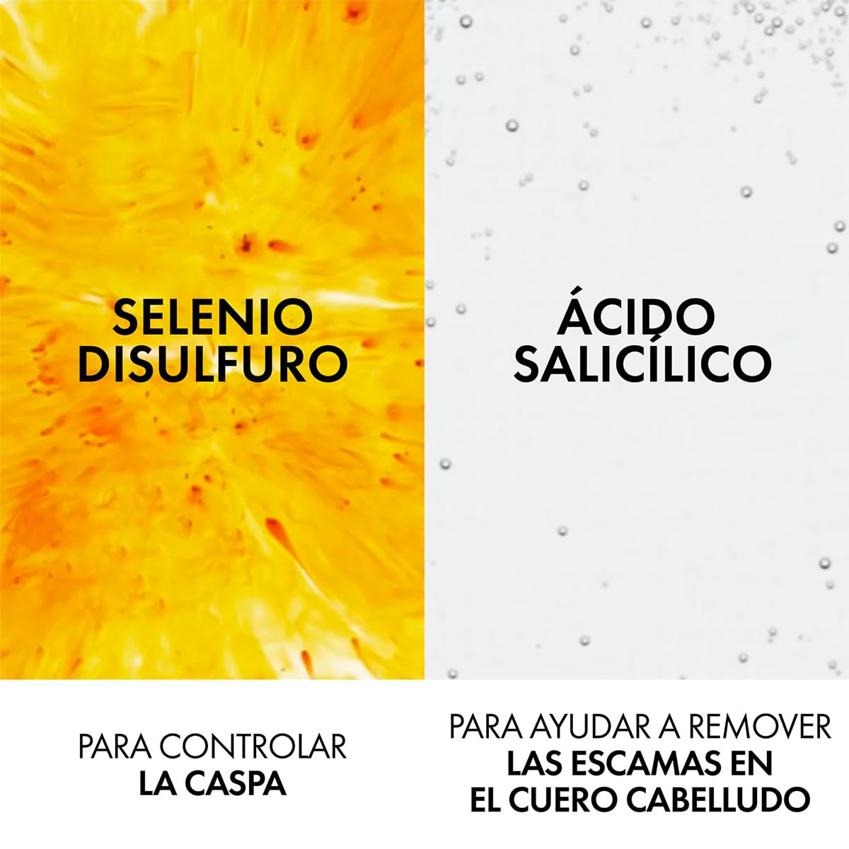 Vichy Dercos Shampoo Dermatológico Anti-Caspa Cabello Normal a Graso 390ml