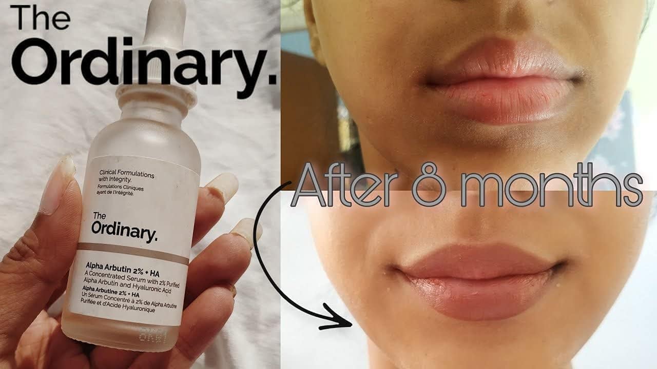 Deciem Alpha Arbutin The Ordinary 2% + HA, 30 ml