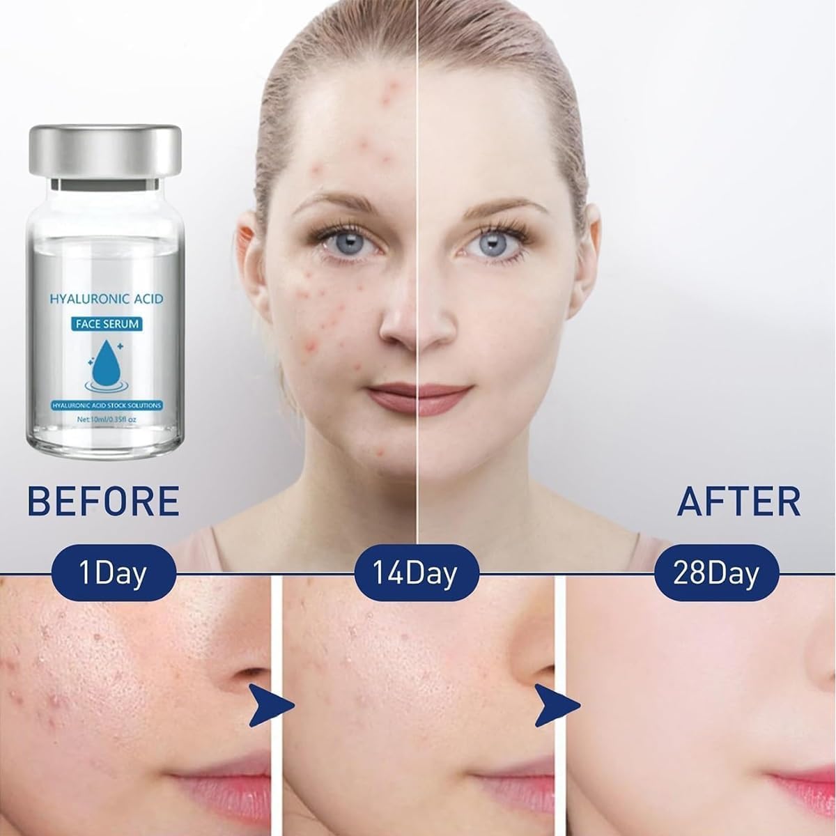 Set of 5 Micro Infusion System with Facial Serum for Skin Care - Glamorys Ultimate Facial Treatment Kit