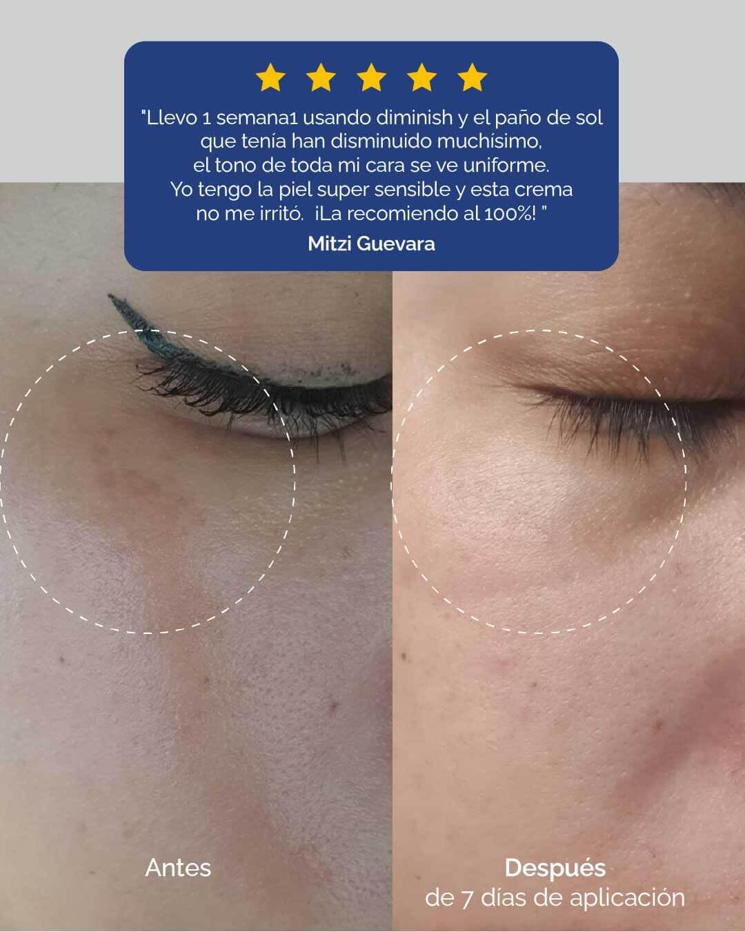 KareCo Diminish Despigmentante facial en Crema| Reduce manchas y líneas de expresión | Ácido Azelaico, Ácido Hialurónico y Vitamina C | Obtén una piel uniforme y radiante | agregalo a tu skin care