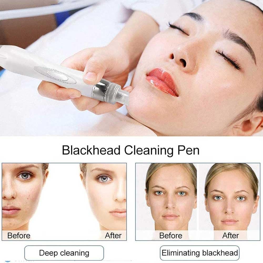 Máquina Facial de Oxígeno de Hidrógeno 7 en 1, Instrumento de Belleza de Burbujas Pequeñas, Diamante Dermoabrasión, Multifuncional de Limpieza Hydro Portátil, para el Hogar, Spa