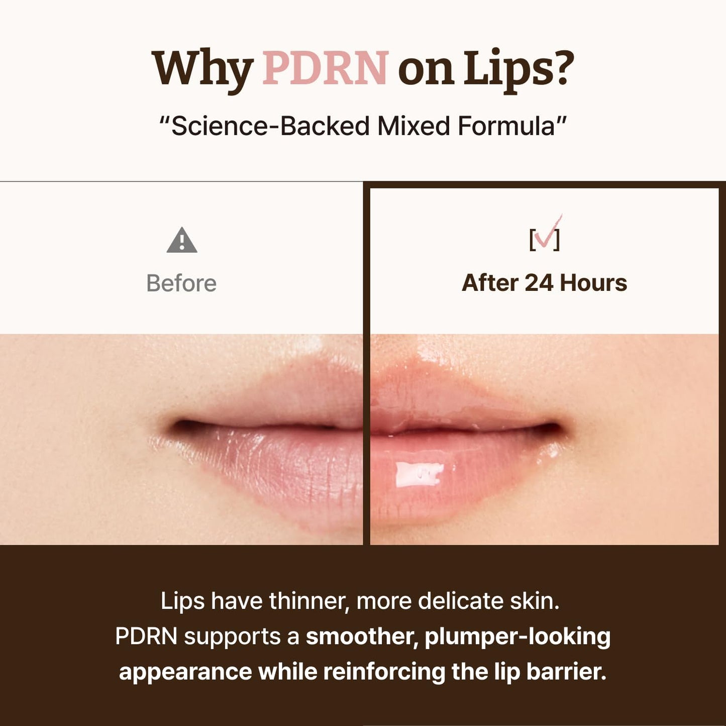 Dr.reju-all Advanced Pdrn Rejuvenating Lip Serum ? Hydrating Lip Balm with Lipozip for Glowy, Dewy Lips ? Gentle Exfoliating & Smoothing Lip Moisturizer ? Hibiscus & Lactic Acid ? 0.3 Fl Oz