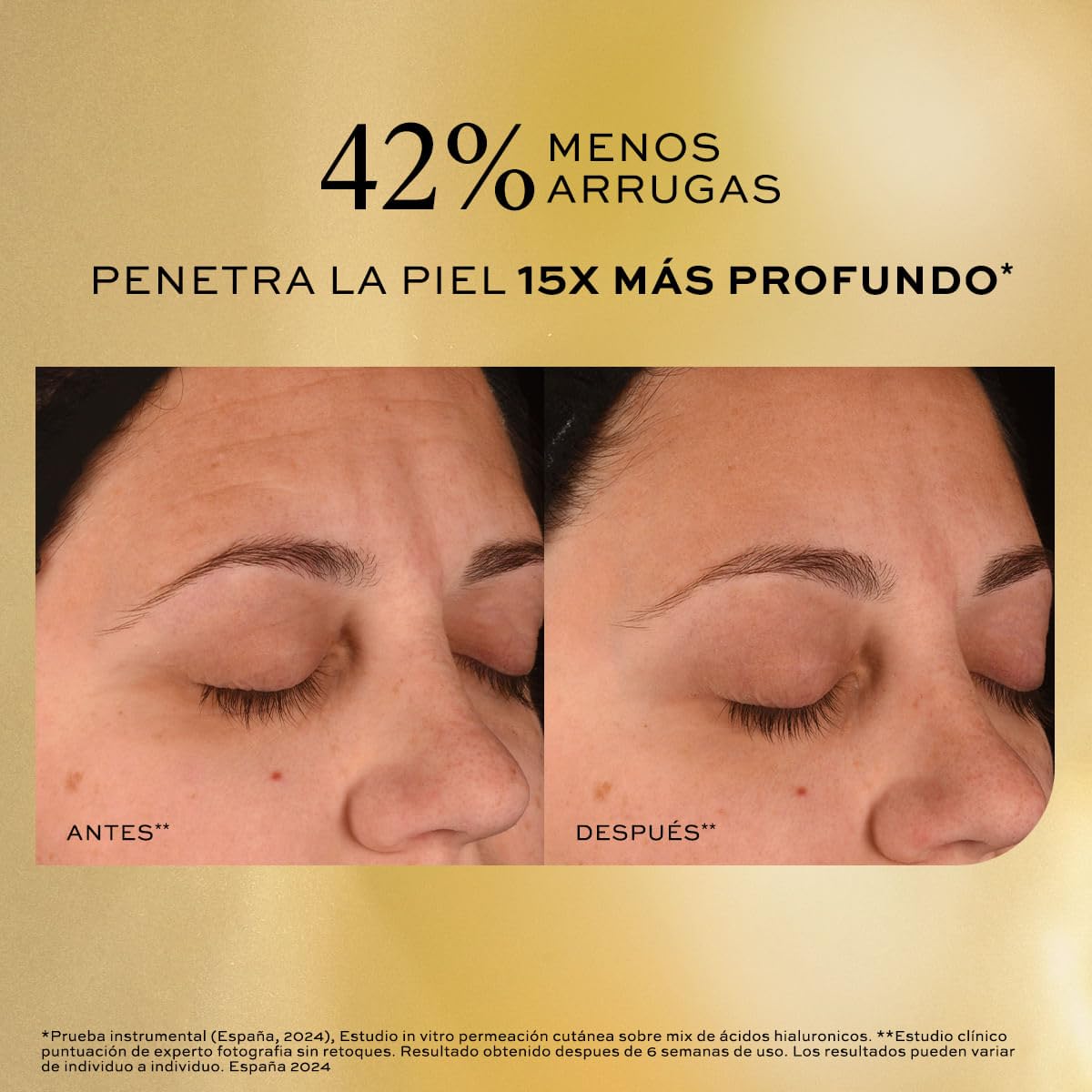 L'BEL - Concentré Sérum Relleno de Arrugas 15% Ácido Hialurónico Edición Limitada, Reduce Arrugas y Efecto Relleno, Piel Más Lisa e Hidratada, Uso de Día y de Noche