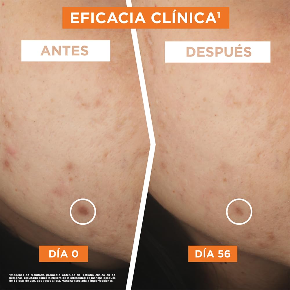 Kit Garnier Express Aclara Rutina anti manchas con Vitamina C: Sérum facial, crema hidratante y gel limpiador, 3 piezas. Hidrata, ilumina y unifica el tono de la piel