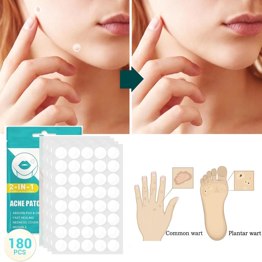 Parches de Piel Hidrocoloides para Acné - Tratamiento Absorbente para Espinillas en la Cara - Pack de 180 Calcomanías Ultra Finas - Cuidado Profesional para la Piel - Absorben Secreciones para una Piel Más Sana y Limpia