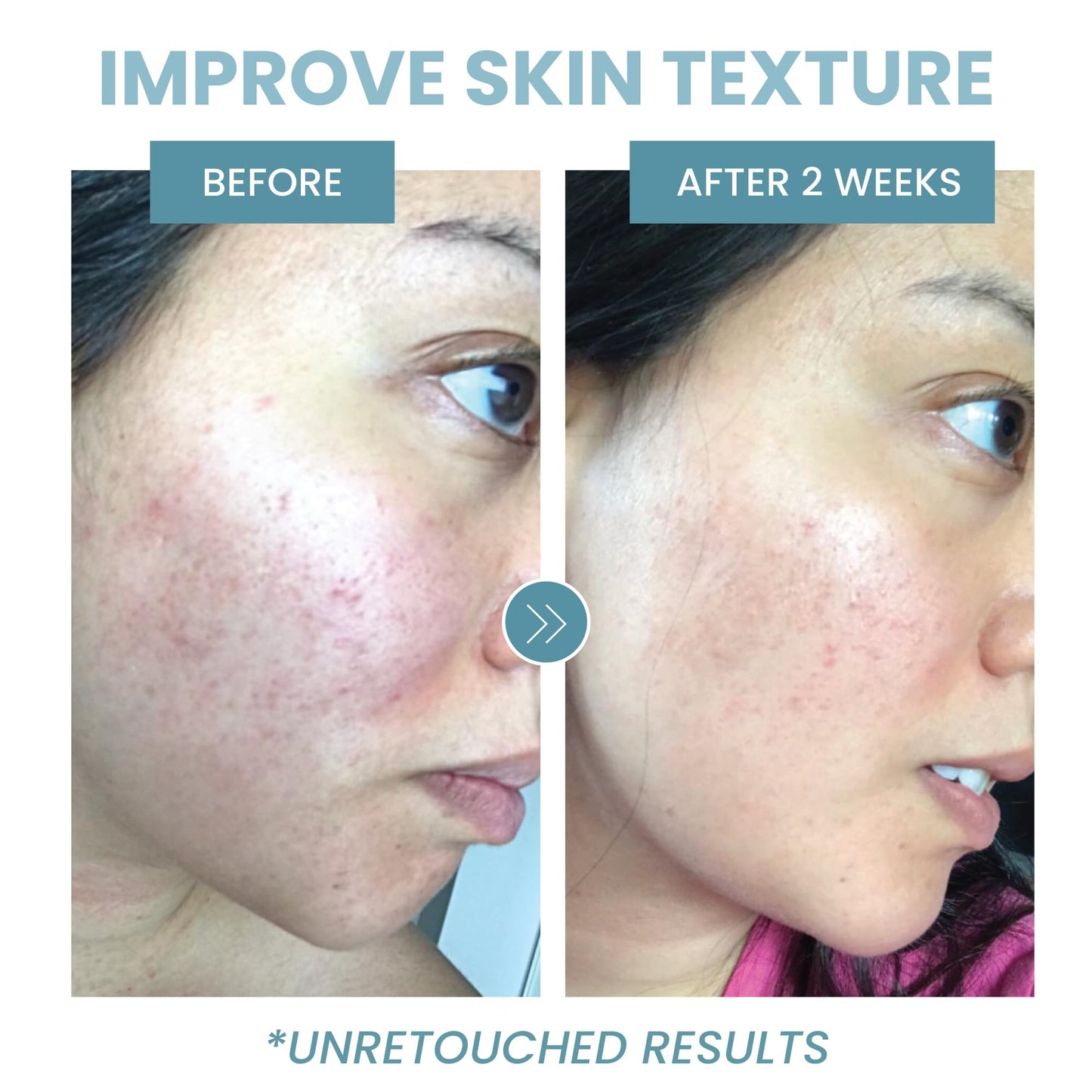 Peptide Complex Serum by Eva Naturals (2 oz) - Best Anti-Aging Face Serum Reduces Wrinkles and Boosts Collagen - Heals and Repairs Skin while Improving Tone and Texture - Hyaluronic Acid & Vitamin E