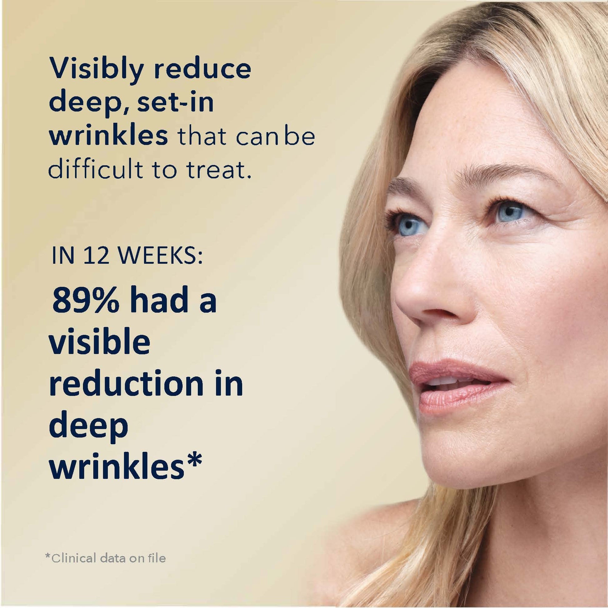 RoC Deep Wrinkle Serum, 1 Ounce