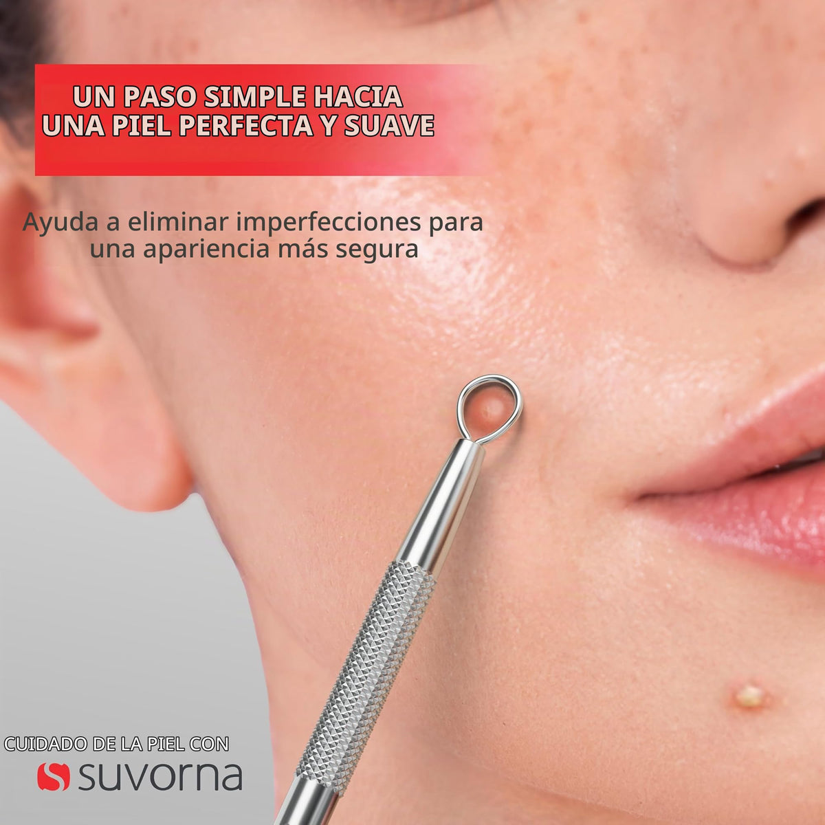 Herramienta para eliminar milia Suvorna Skinpal, removedor de granos, extractor para granos, puntos negros, puntos blancos, comedones, acné, espinillas, imperfecciones, quistes y manchas.
