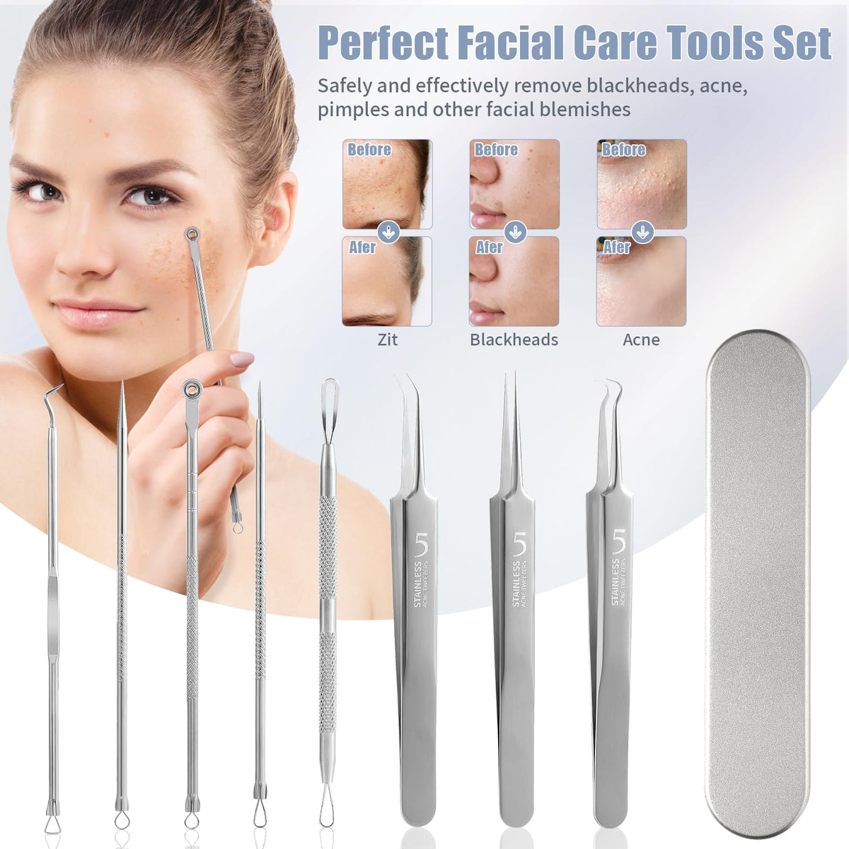 FEITA - Kit de herramientas para quitar espinillas, extractor de espinillas, herramientas para acné para nariz facial, aguja de acné de acero inoxidable, herramienta de eliminación de golpes faciales