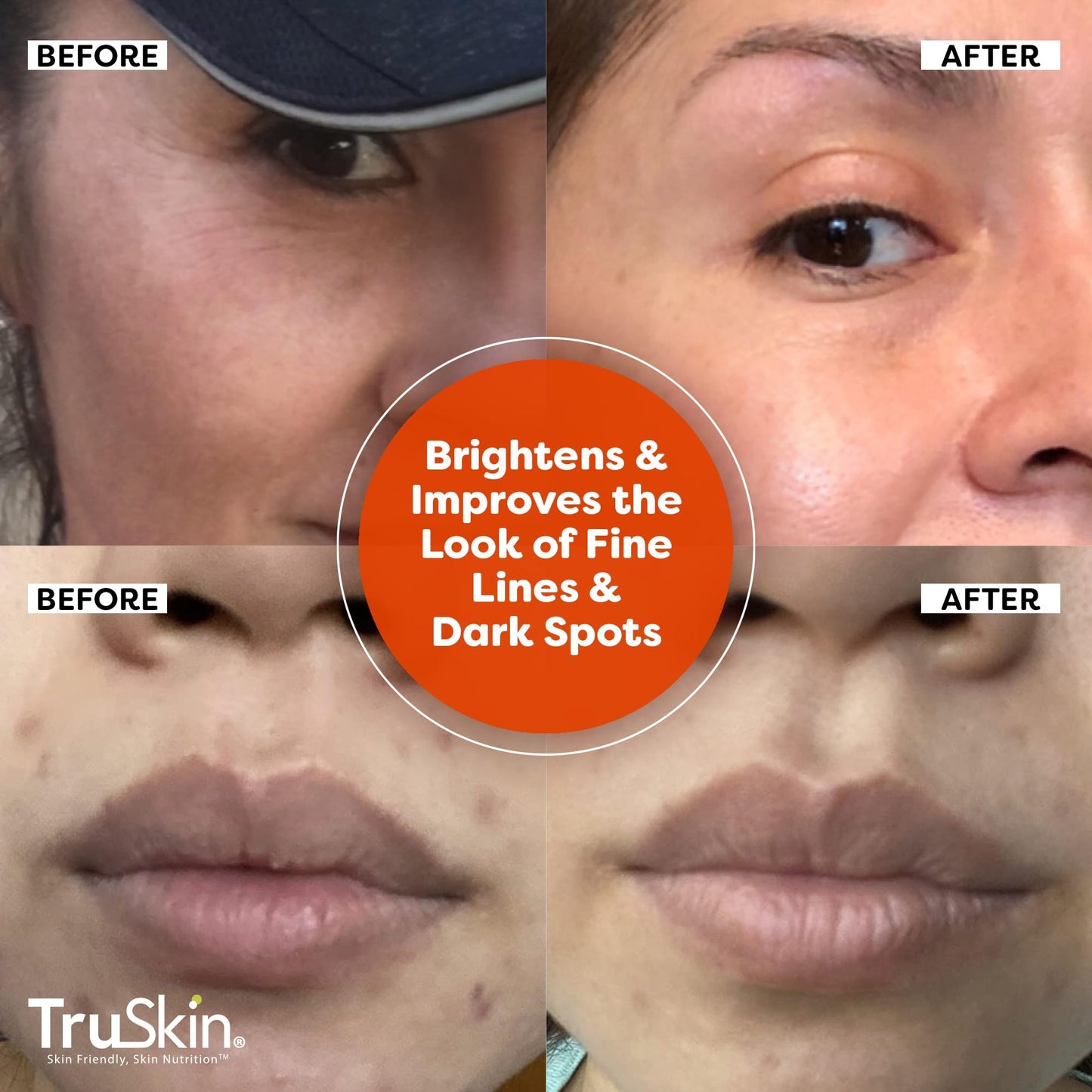 TruSkin Naturals Vitamin C Serum for Face, Topical Facial Serum with Hyaluronic Acid & Vitamin E, 1 fl oz.