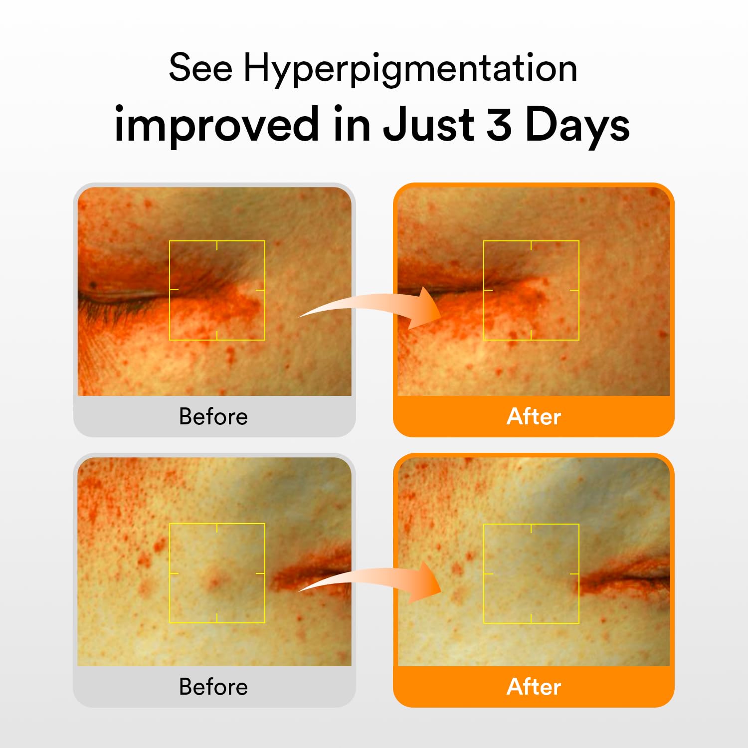 Suero para manchas oscuras con glutatión Vita drop 50 ml/1,69 fl.oz. | Cuidado de la piel coreano, tratamiento para manchas oscuras e hiperpigmentación | Suero iluminador para pieles sensibles y