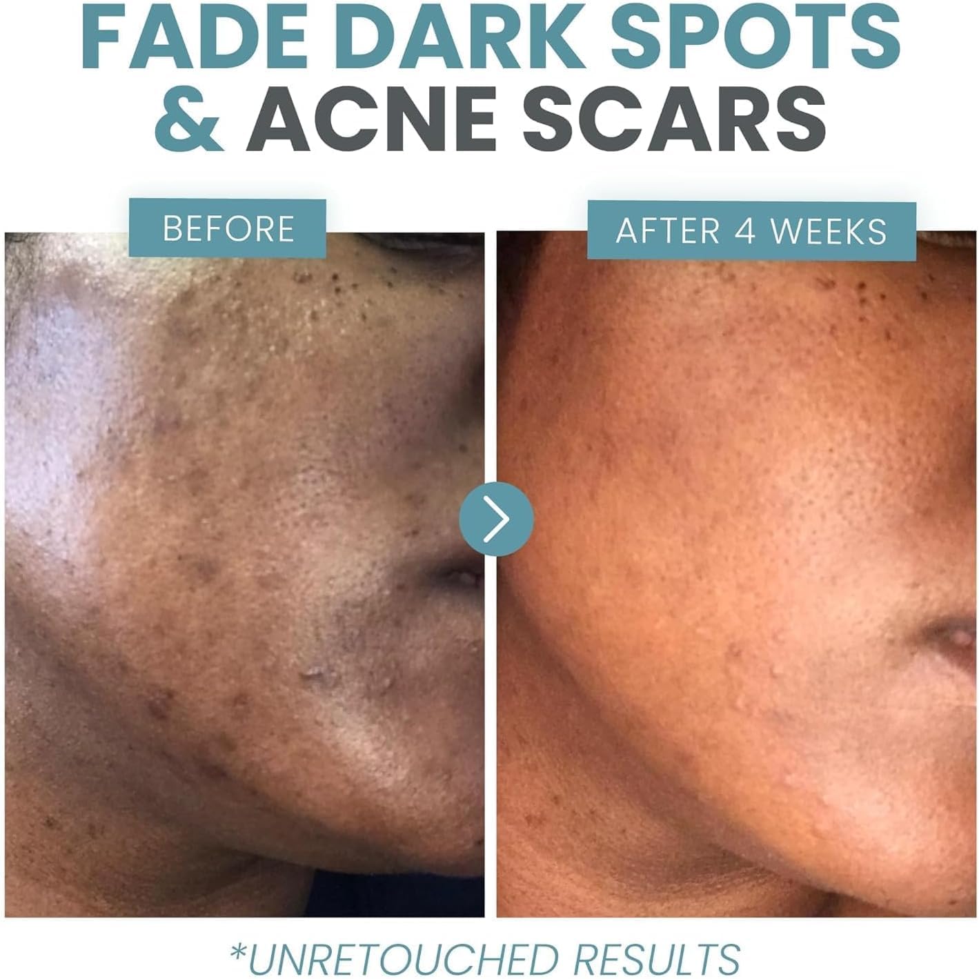 Eva Naturals suero de vitamina C más 2% de retinol, 3,5% de niacinamida, 5% de ácido hialurónico, 2% de ácido salicílico, 10% de MSM, 20% de vitamina C – suero de limpieza de la piel – reparación antienvejecimiento de la piel, suero facial (2 oz)