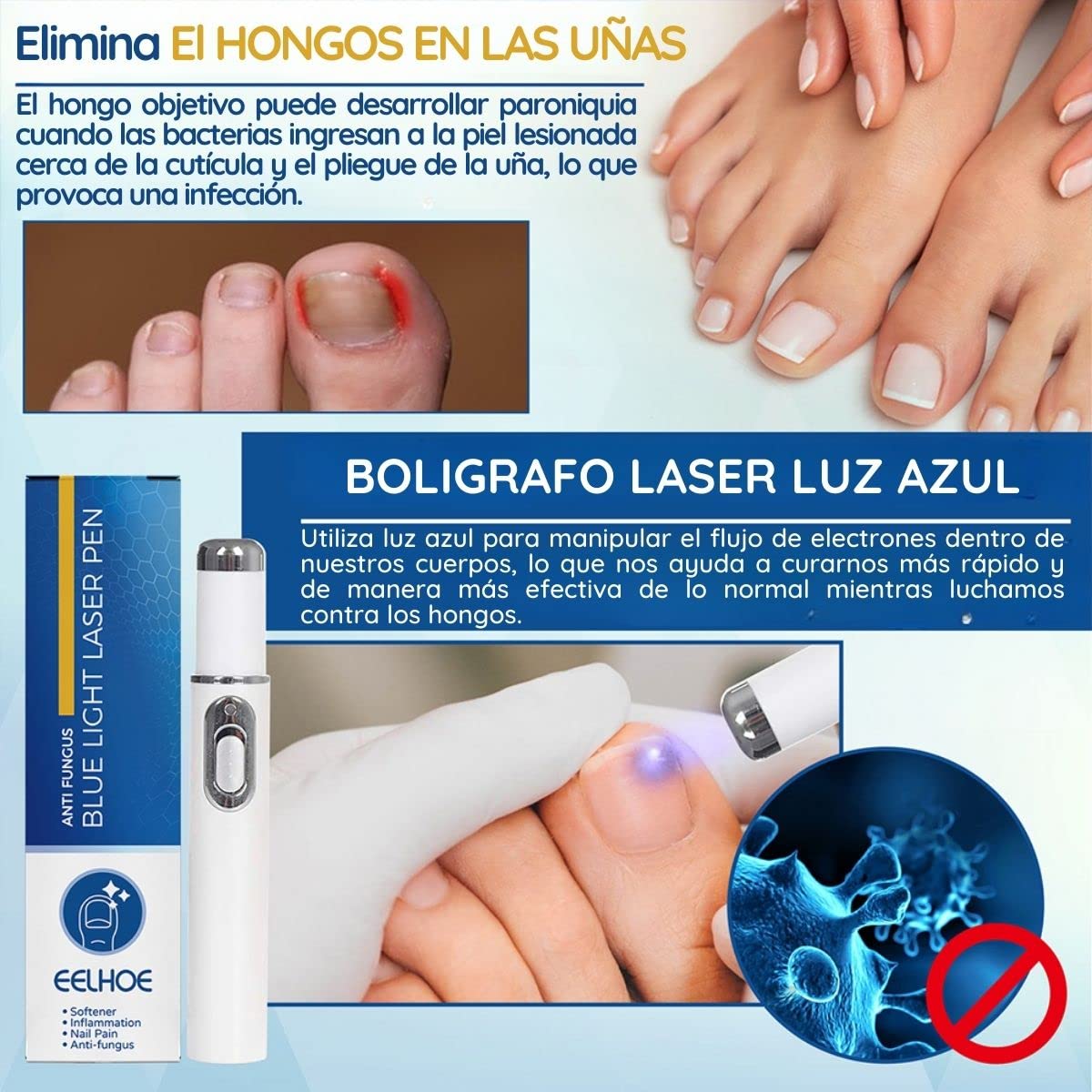 EELHOE Bolígrafo Luz Azul para Tratamiento de Hongos en Uñas - Elimina Onicomicosis y Paroniquia