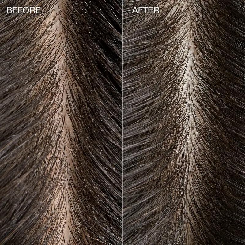 Exfoliante de Sal Tea Tree Espumosa Desintoxicante 184 Gramos para Todo Tipo de Cabello