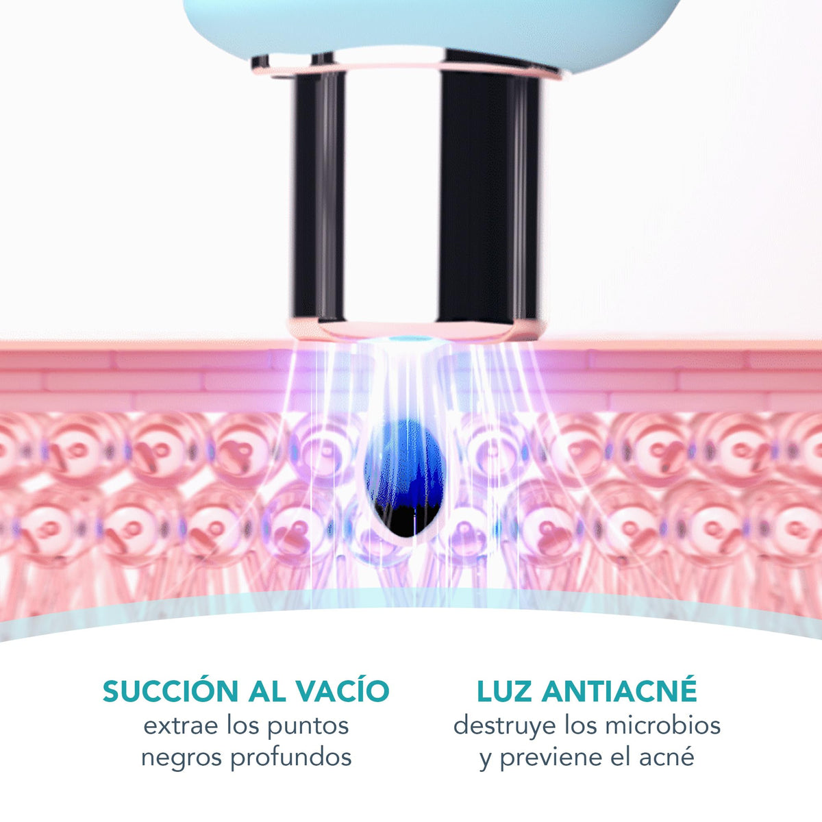 FOREO KIWI – Limpiador facial eléctrico – Succionador de puntos negros – Exfoliante facial con punta de diamante – Eliminación de espinillas y granos – Limpieza profunda de poros