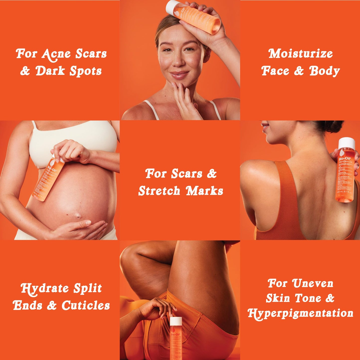 Bio-Oil® 6.7oz: Multiuse Skincare Oil